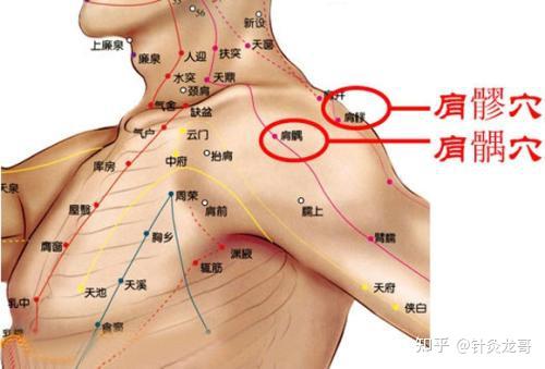 肩周炎准确位置图片图片