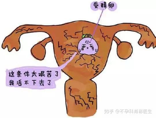 子宮內膜增厚會影響懷孕嗎