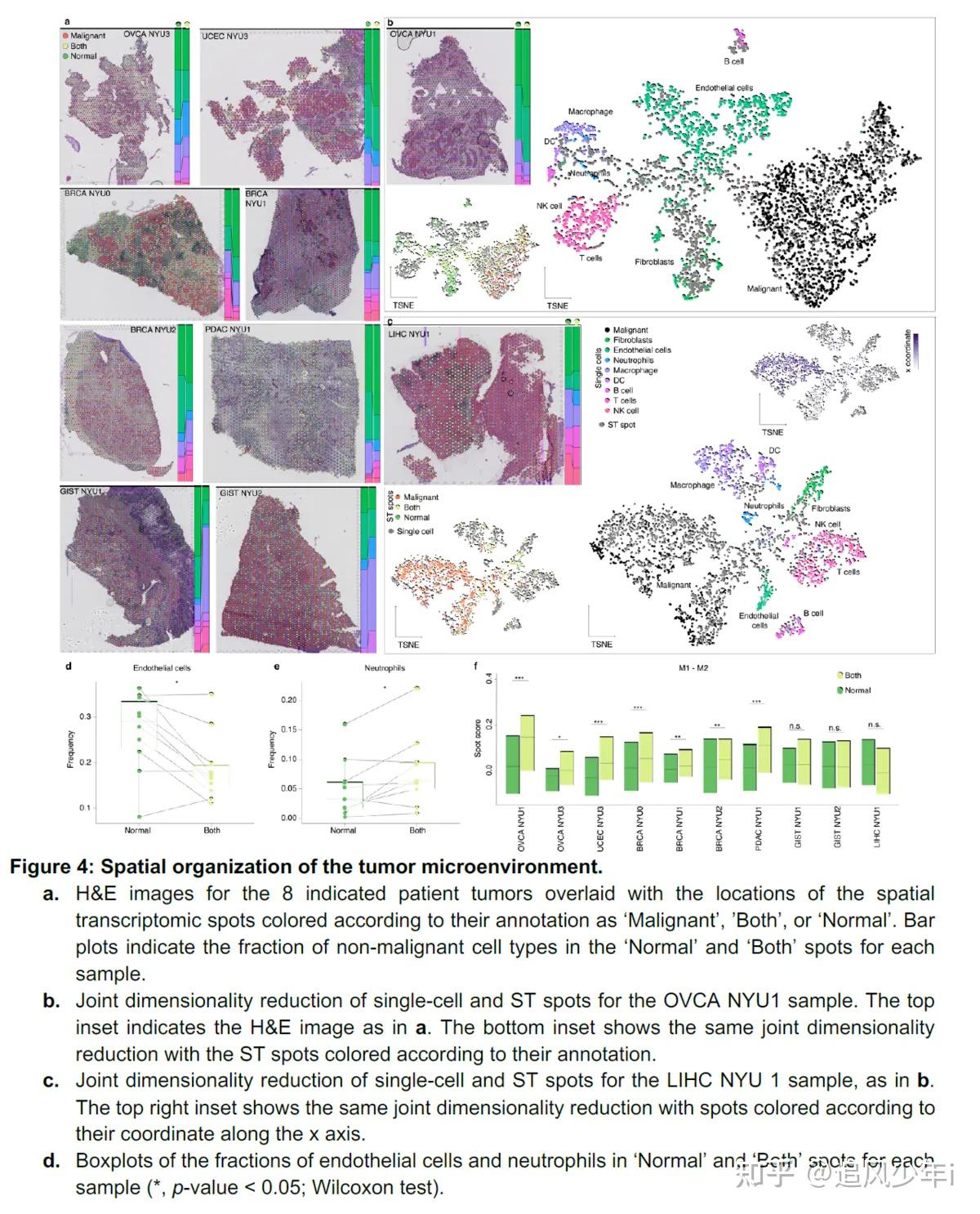 of malignant and non-malignant cell types in the tumor