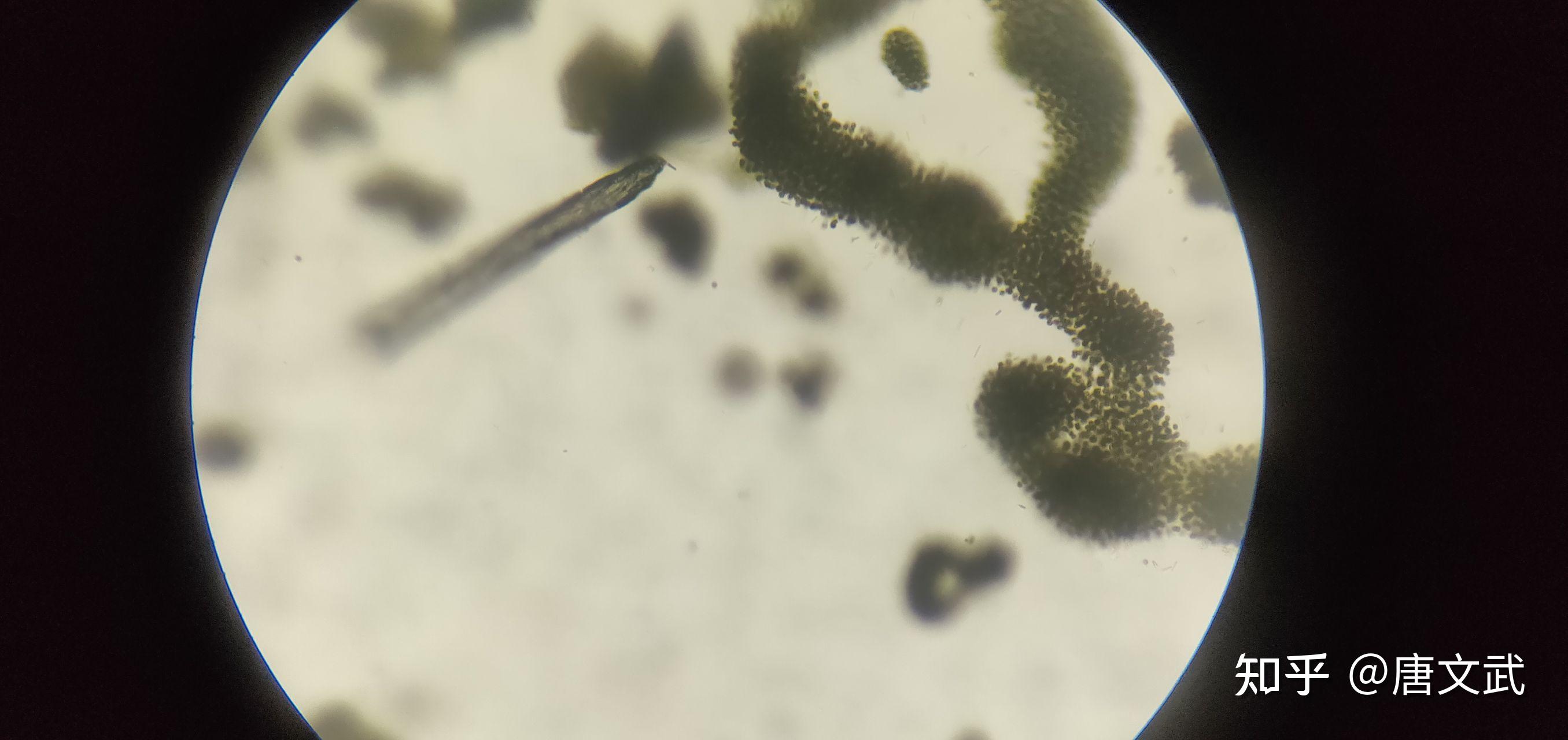 显微镜下海藻图片