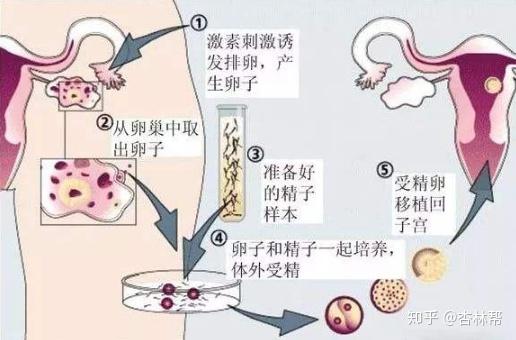 代怀助孕