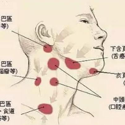 颌下淋巴结肿大压痛 知乎