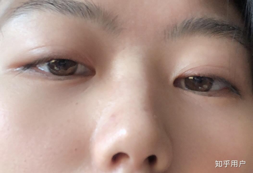 鼻孔太小是种什么怎样的感觉