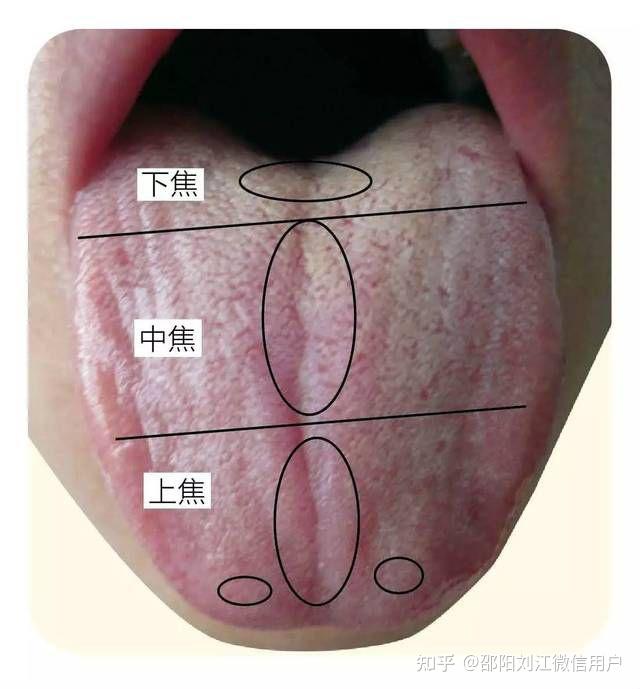 中医病因学说:水湿痰饮〈38〉