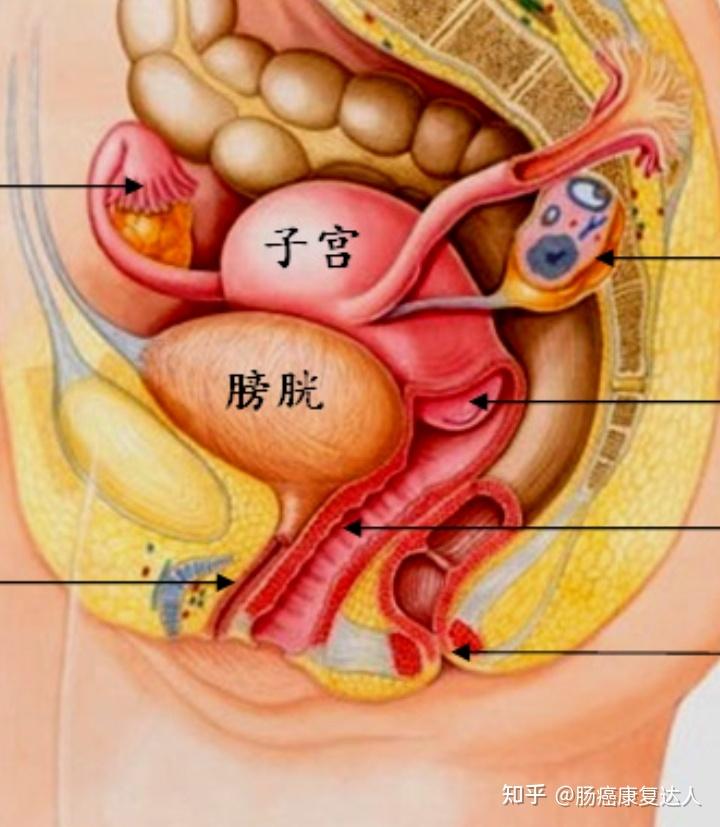 骨盆直肠间隙位置图图片