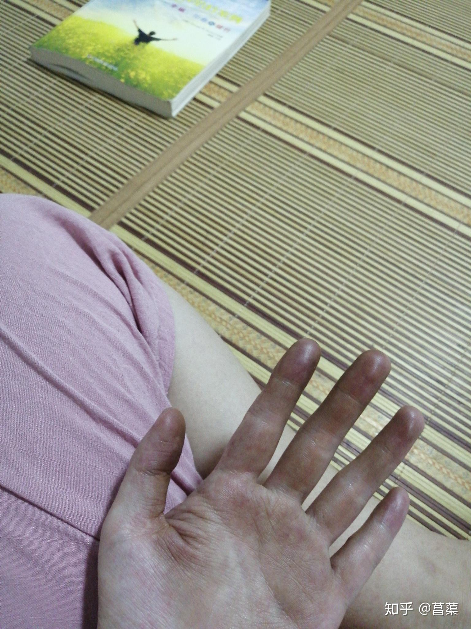洗屁股有白色分泌物正常吗 v2-0b3b9cd4f13d307bb28d50253aac0e5c_r.jpg