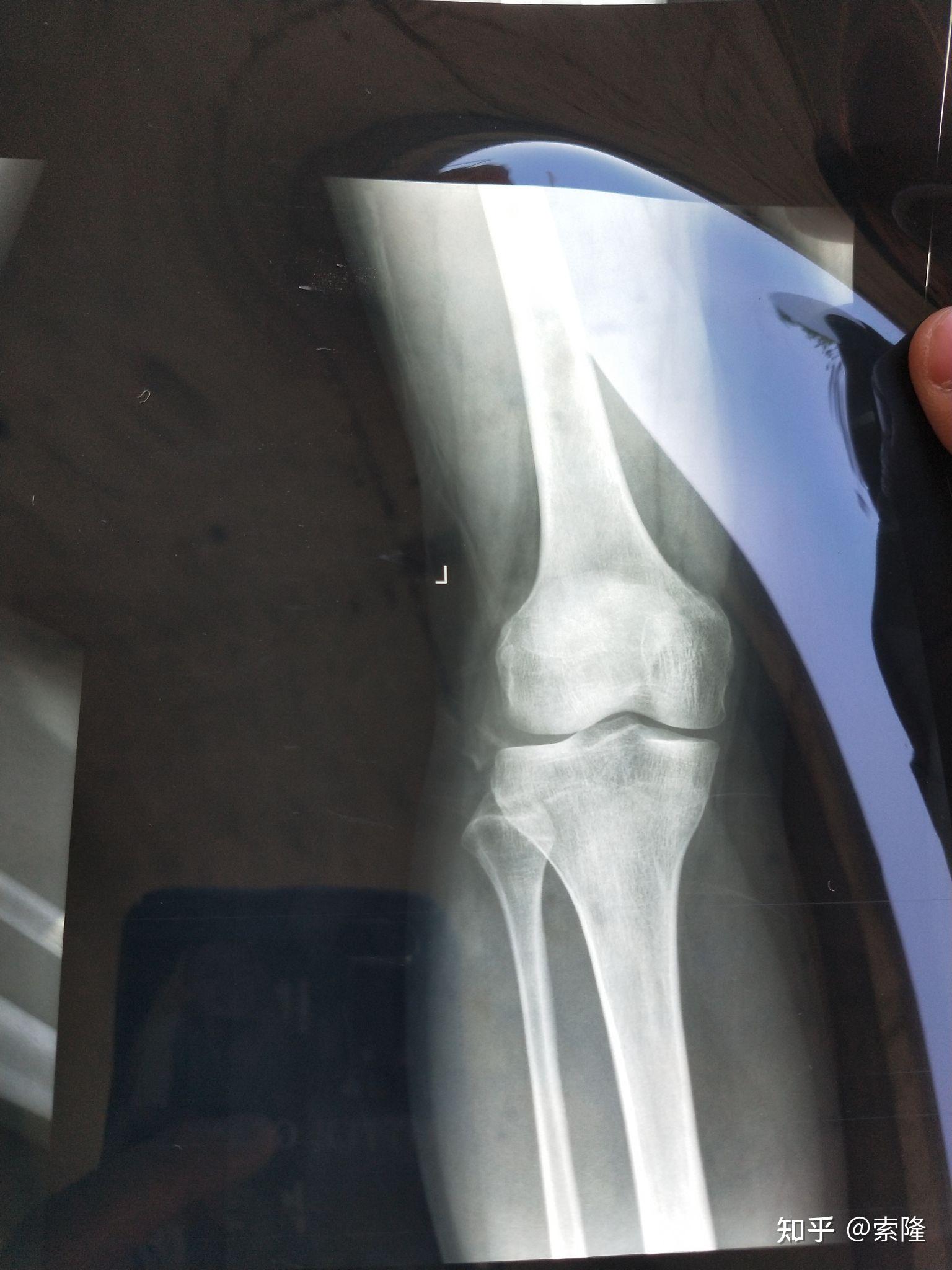 有会看骨垢线片子的吗