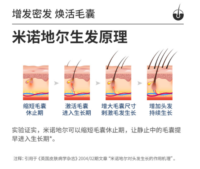 米诺地尔停用后脱发会更严重吗