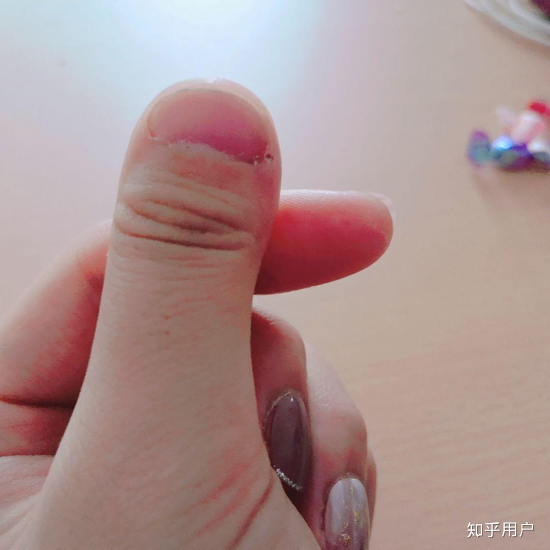 为什么我的大拇指又宽又短? - 知乎
