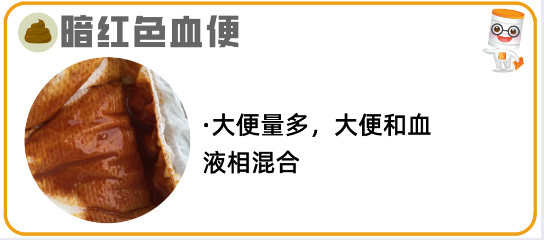 逾20种宝宝大便图片详解!最后10种必须警惕! - 知乎