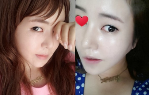 美护揭秘 让女性年轻岁的韩国整形外科的提眉 面部提升术 知乎 美护揭秘 让女性年轻岁的韩国整形外科的提眉 面部提升术 知乎