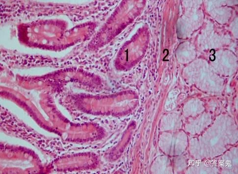 横切 he染色10×10 图示十二指肠粘膜固有层内染色较深的小肠腺(1)
