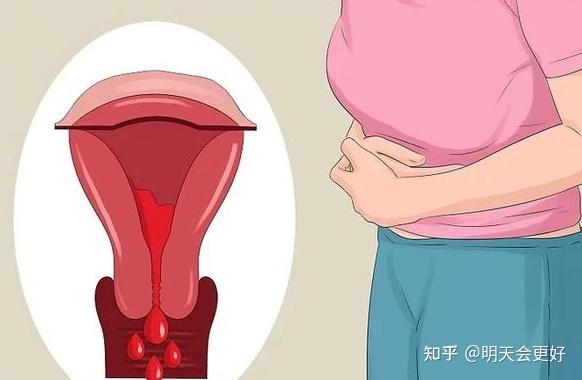 药流后多久来姨妈 关注流产后的女人