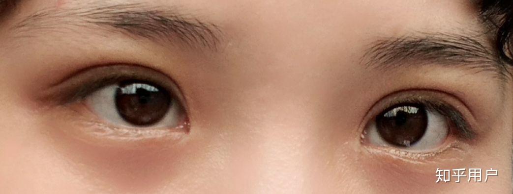 眼神无神和眼睛有神是怎么区别的