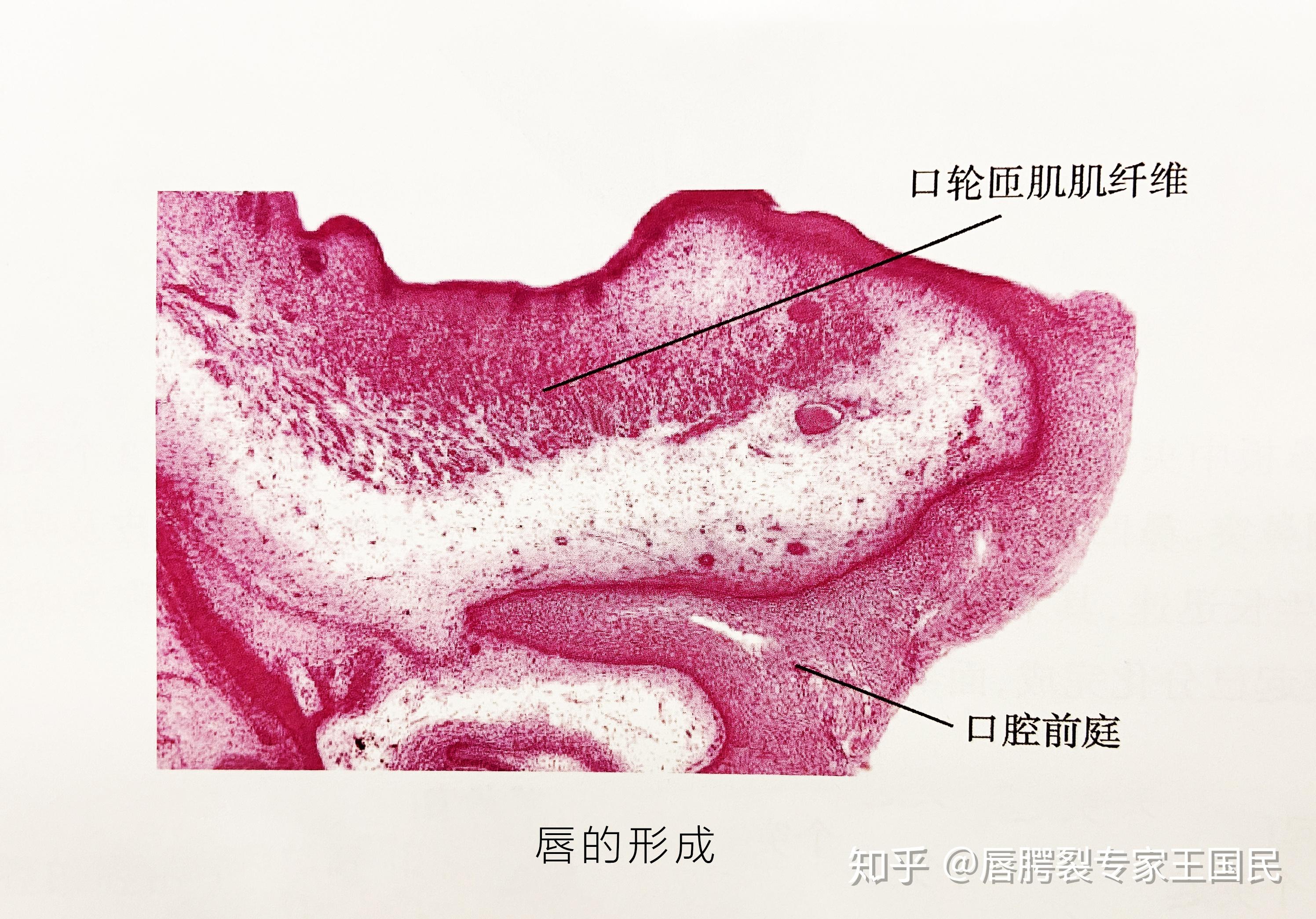 第一节 胚胎时期面部的发育过程-儿科学-医学