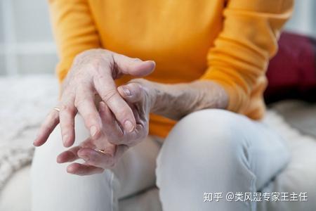 类风湿性关节炎科学治疗四大须知