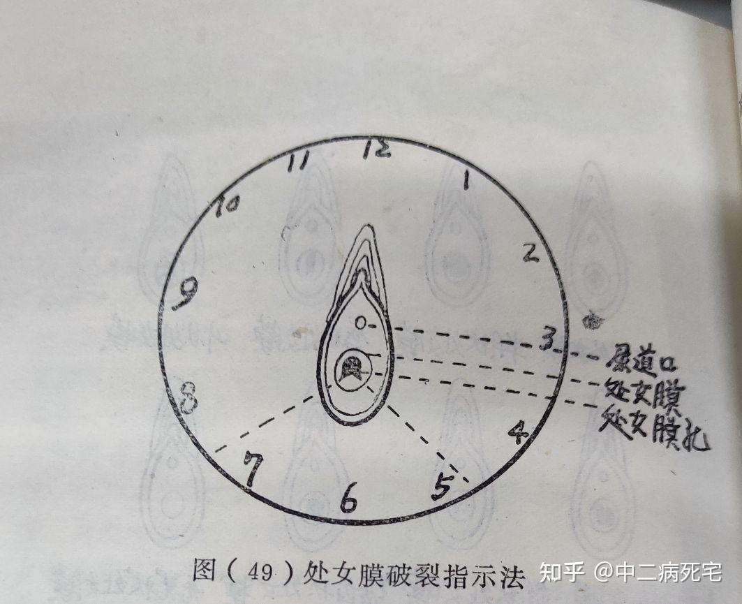 处女膜 