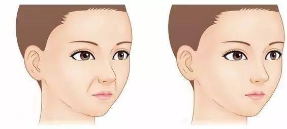 发腮?为什么成年人也会发腮?怎么判断自己有没有发腮? - 知乎