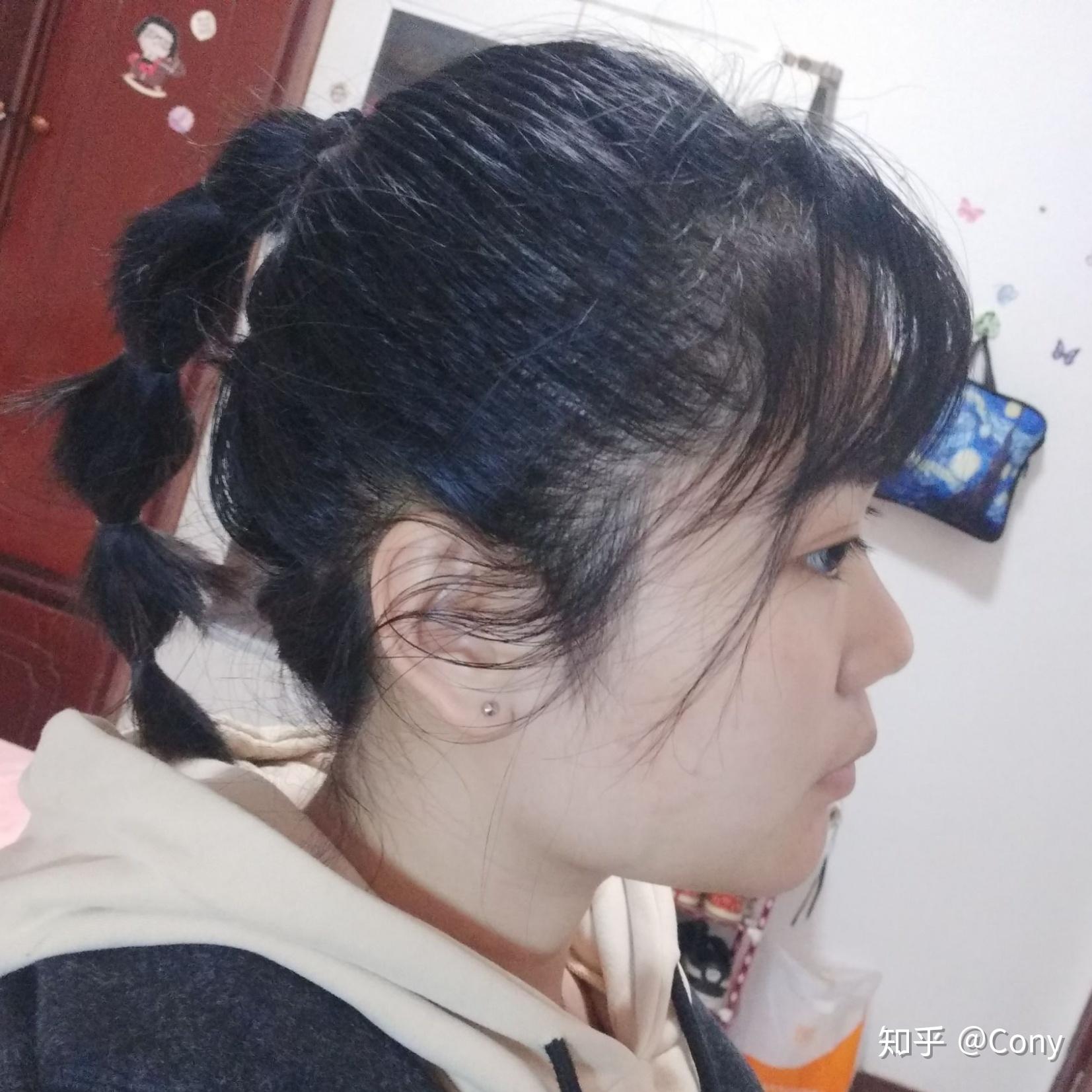 上嘴唇上翘,上翻怎么办?侧面看起来简直丑哭我! - 知乎