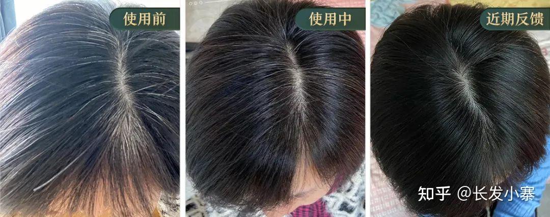 长发小寨给白发者的一封信 - 知乎