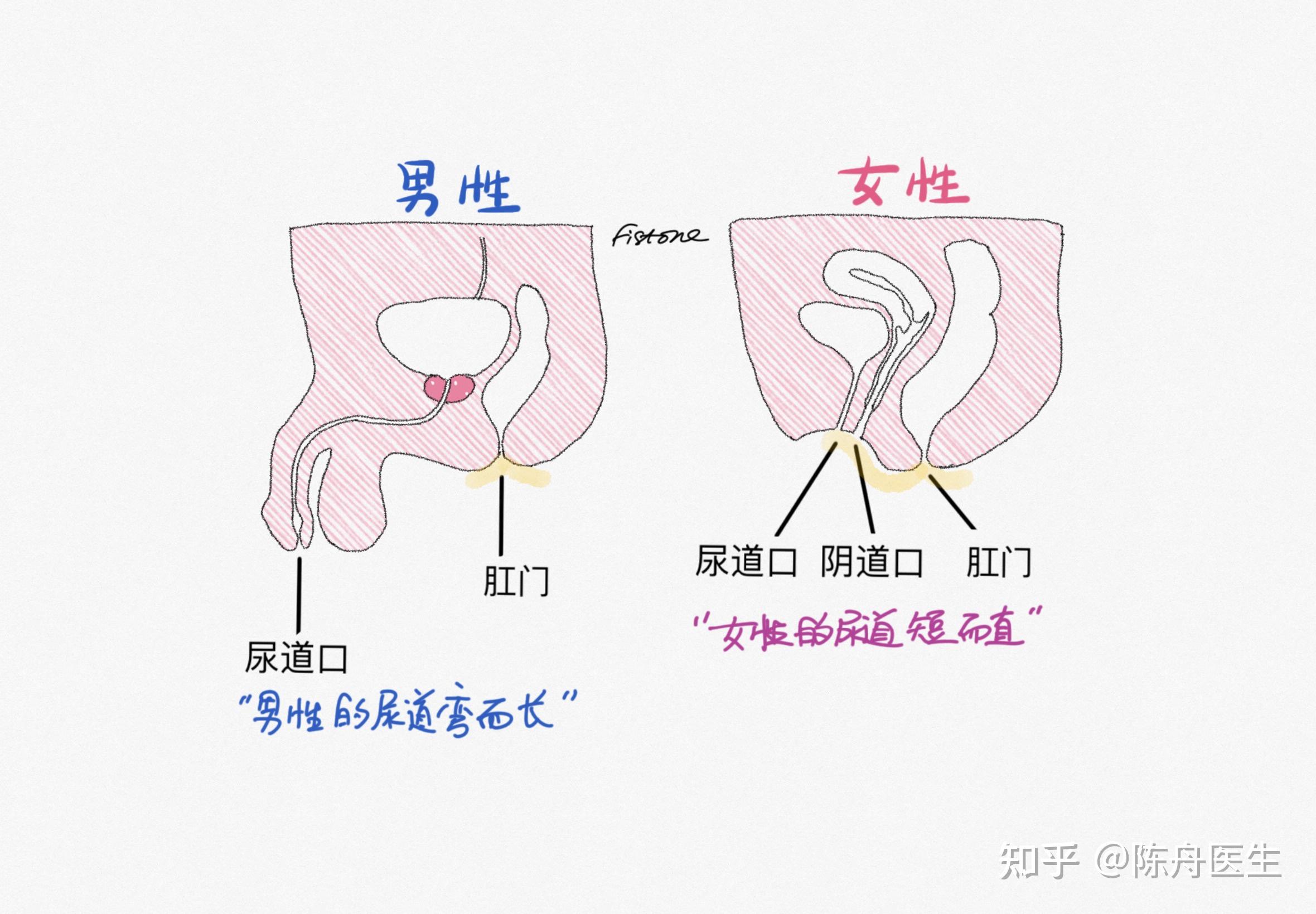 女性尿道口囊肿图片