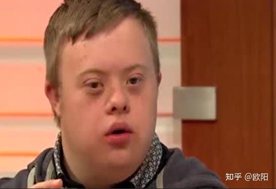 唐氏综合征的孩子不应该出生吗?