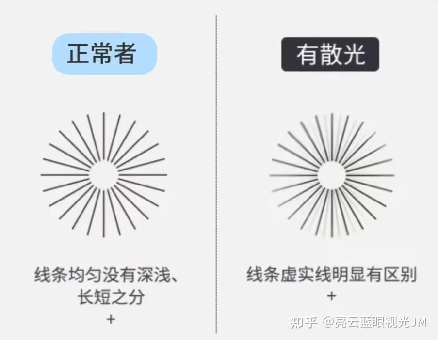 别等孩子散光严重才后悔,散光比近视还要可怕!