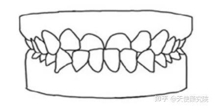 郑秀妍这段太蛊了吧!芒果台怎么能删了不播??!(郑秀妍签约英皇)