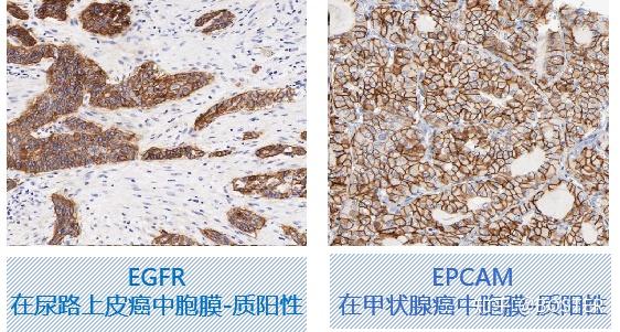 免疫组化(IHC)实验从入门要高阶一篇搞定 - 知乎