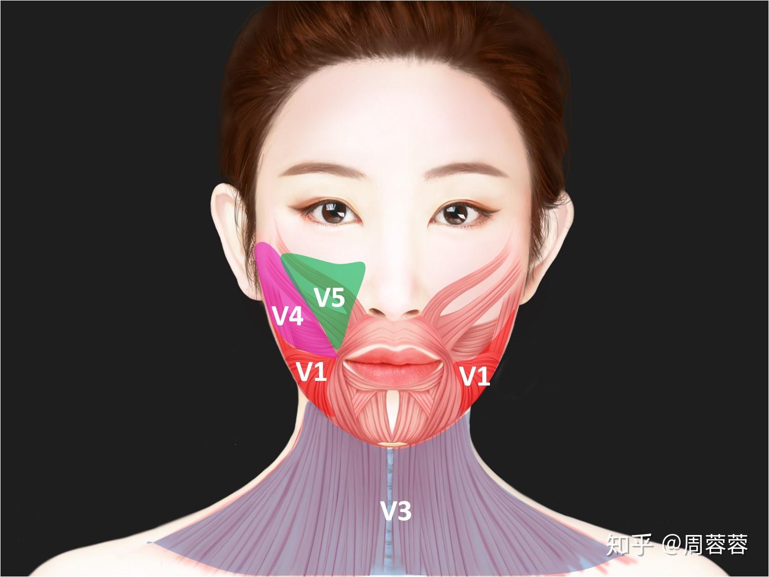 肉毒素 V Codes ®全脸提升&联合治疗（2.0） - 知乎