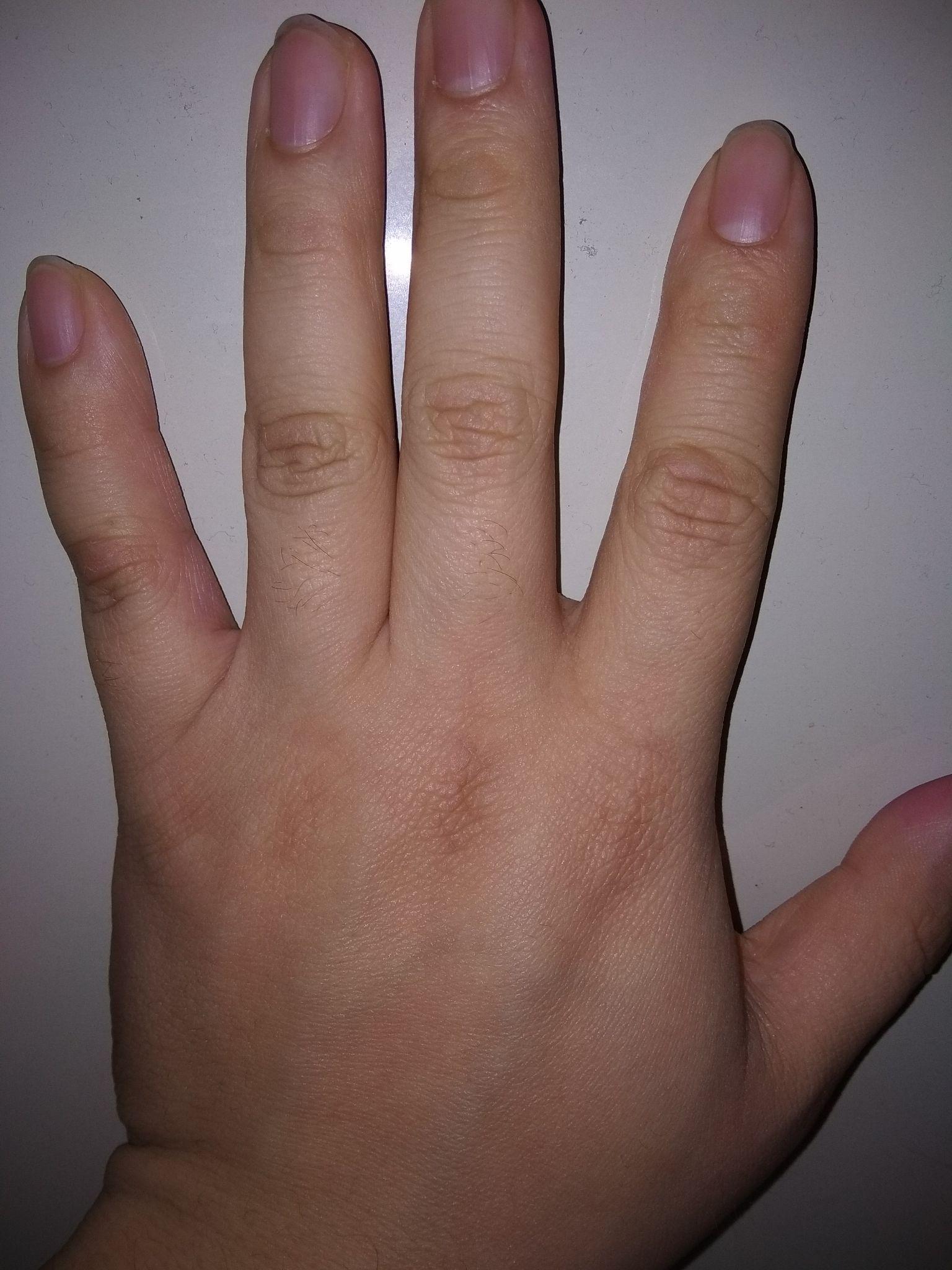 大家的拳茧都啥样了,想见见? - 知乎