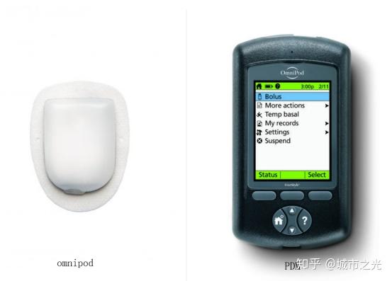 omnipod无管路胰岛素泵