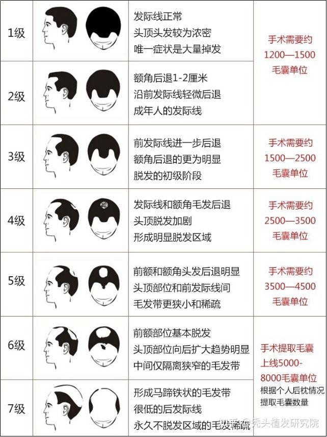 植发费用