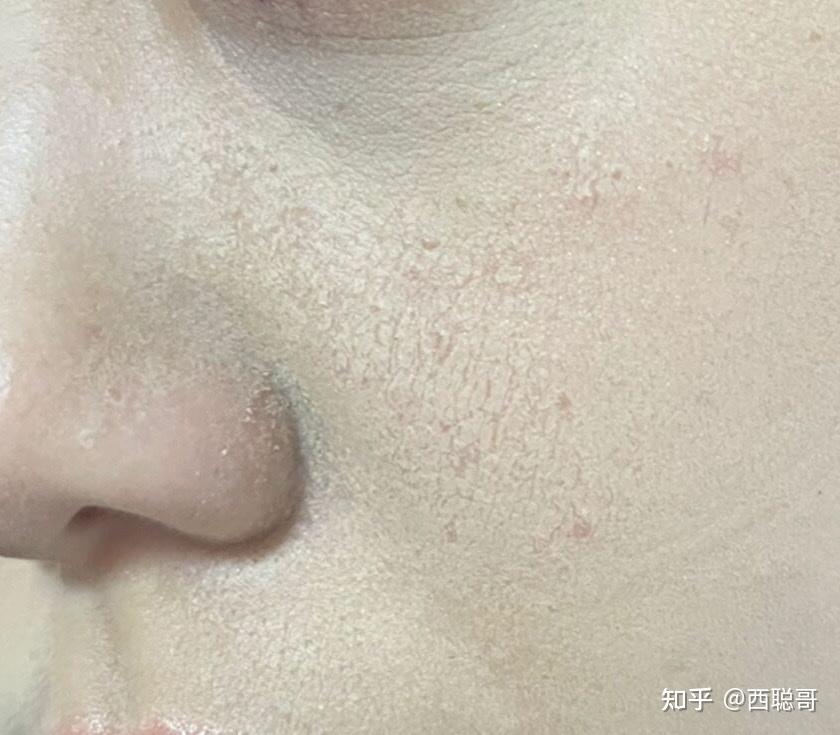 混油皮超级卡粉起皮浮粉怎么办有无护肤品推荐