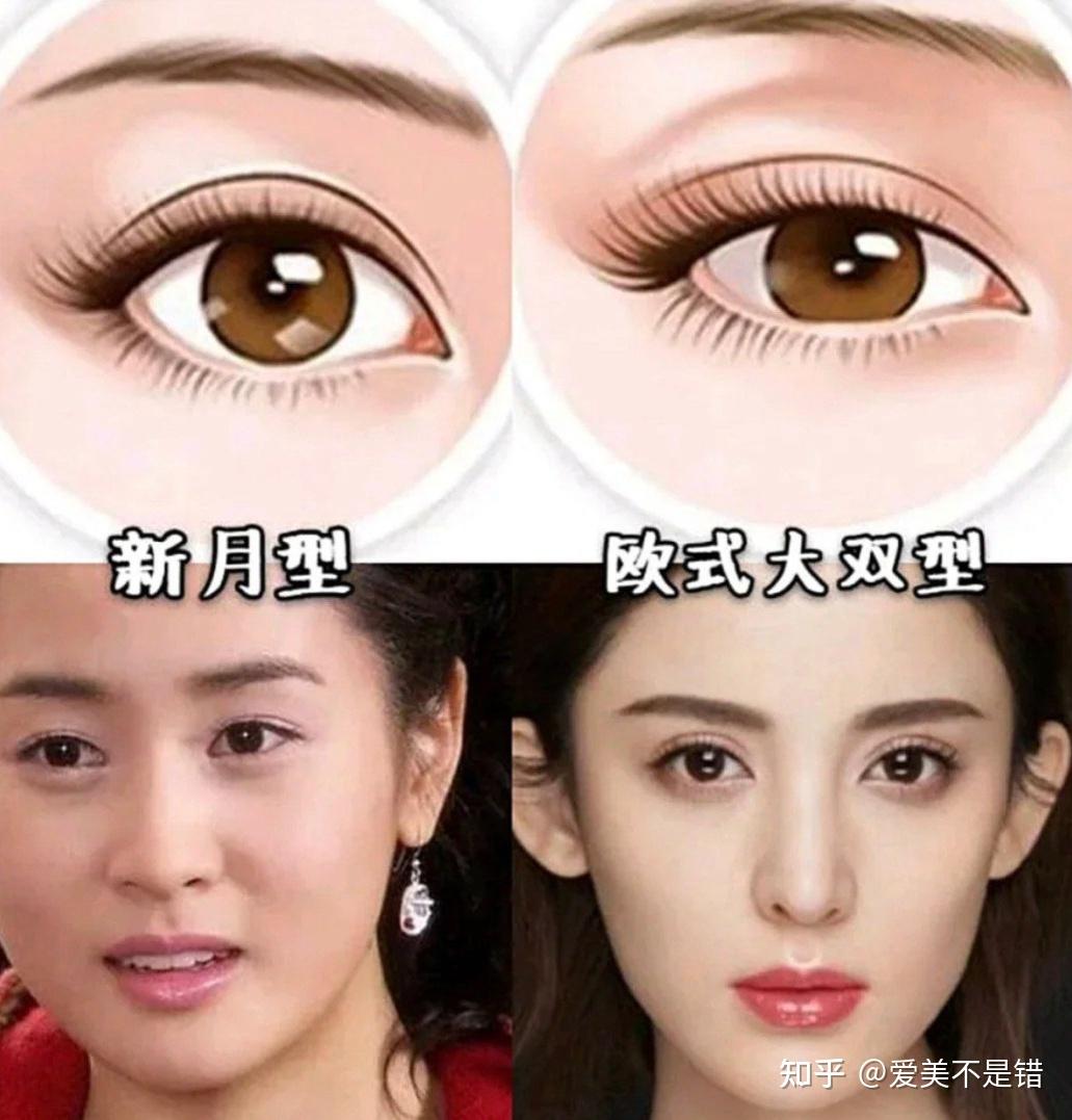 大家都知道,双眼皮形状大致分为4种类型:开扇,新月,平行,平扇.