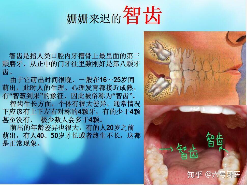 智齿到底是几岁长才正常? - 知乎