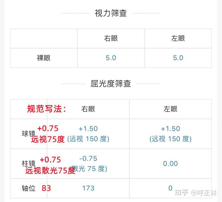 一年级小学生视力球镜150柱镜075裸眼50正常吗