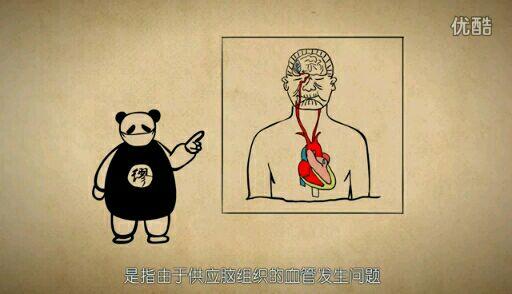 什么是老年痴呆症