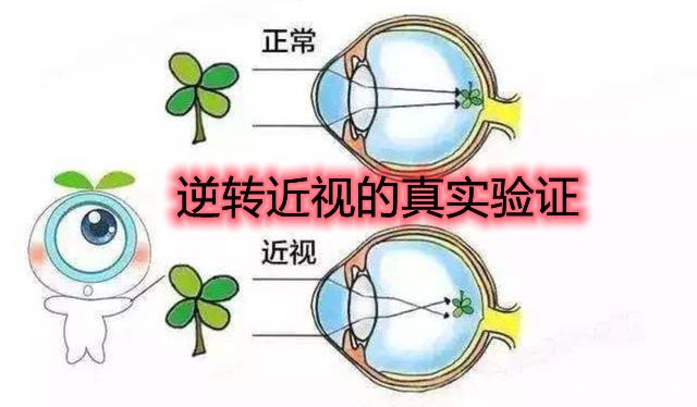 近视是否可逆的真实验证(续8:接下来的几个月至关重要) - 知乎