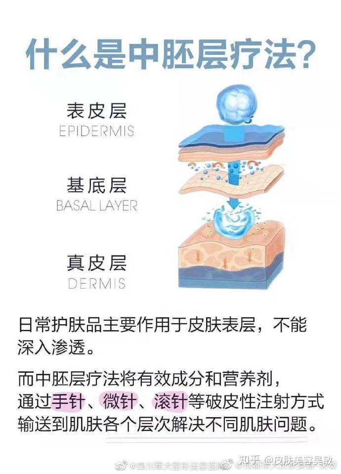 什么事中胚层疗法?