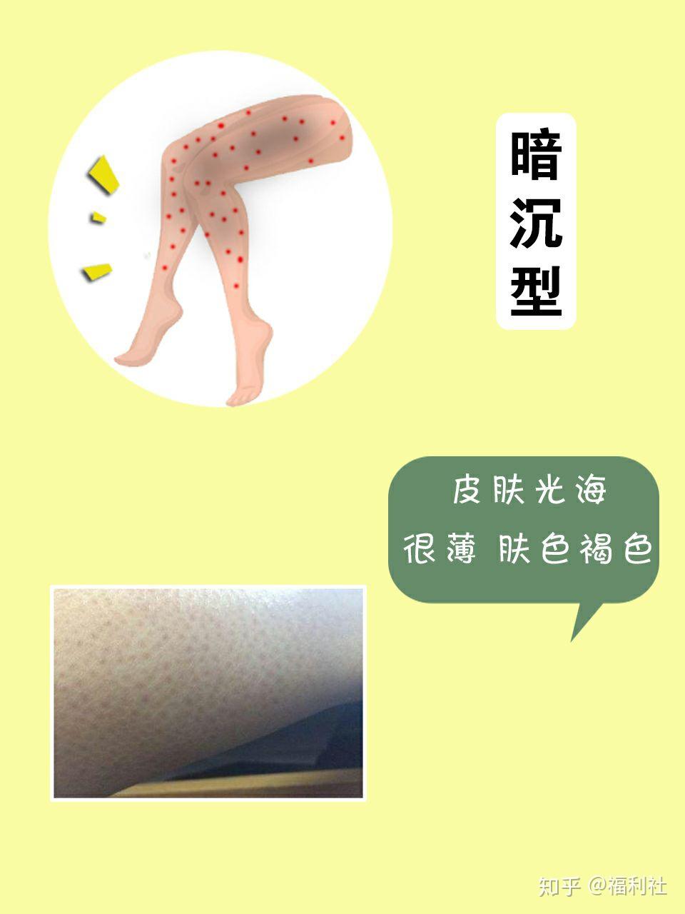 关于鸡皮肤打卡第四天的信息