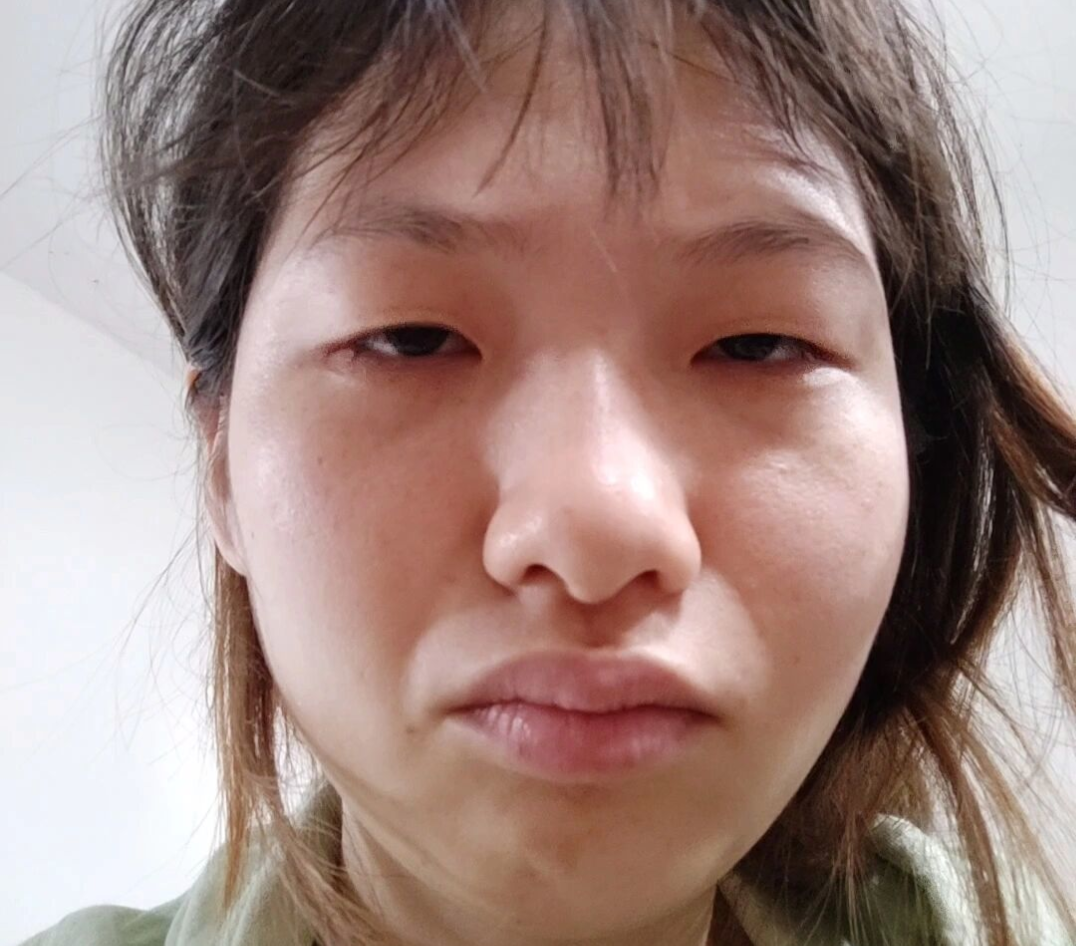 女生长得特别丑怎么办?