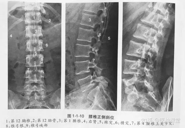 骨关节正常影像表现与变异 - 知乎