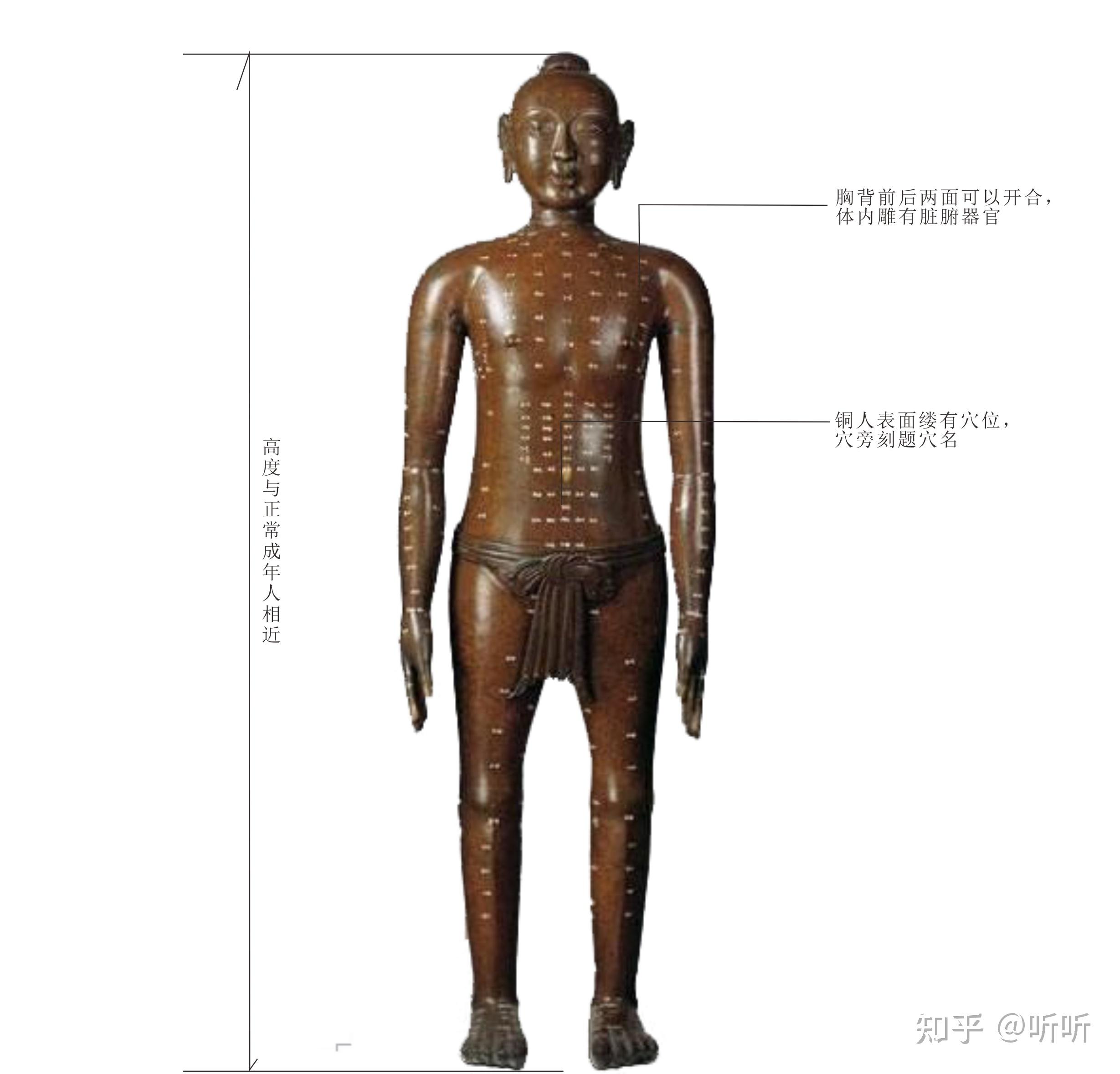 针灸铜人是北宋王惟一创造的,是刻有针灸穴名的人体铜像,形像,直观.