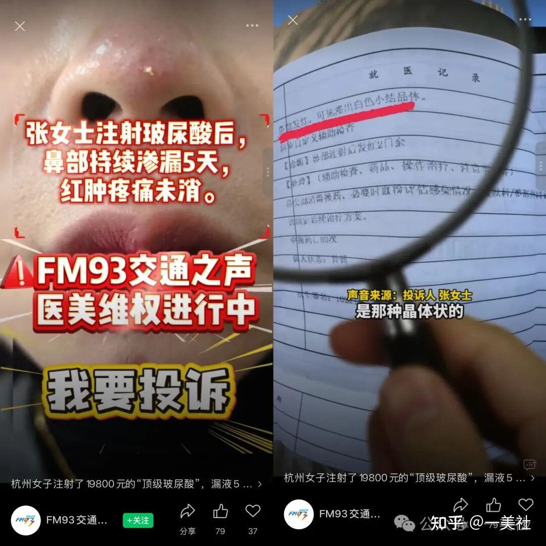 割双眼皮多出分叉线、抽脂后凹凸不平 维多利亚医美客诉不断(图2)