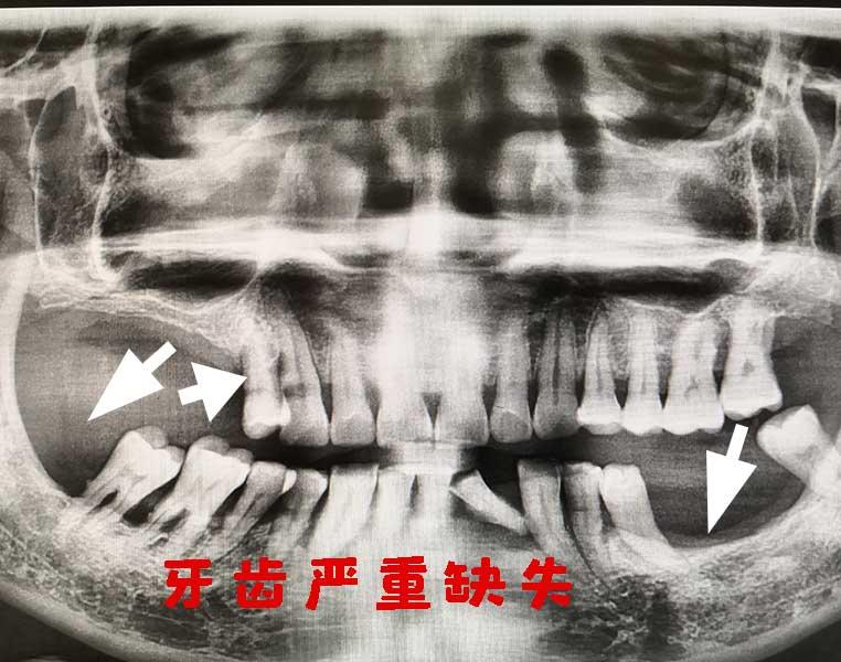 v2-0e6fa5fb196fe18b1db2ab6c6d327ac4_1440w.jpg?source=172ae18b