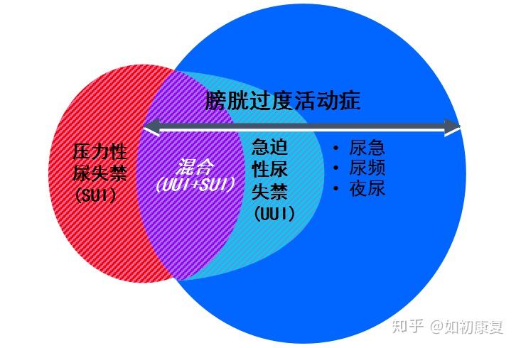 產後尿頻尿急警惕膀胱過度活躍症