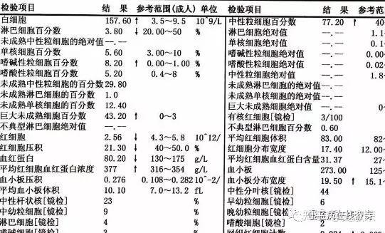 患者如何知道患上慢粒白血病,血常规有哪些明显变化?