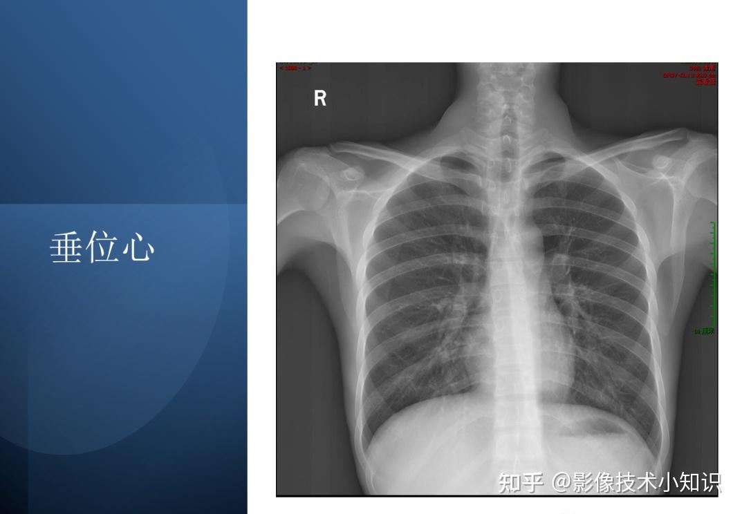 对你很有帮助的心脏影像知识 - 知乎