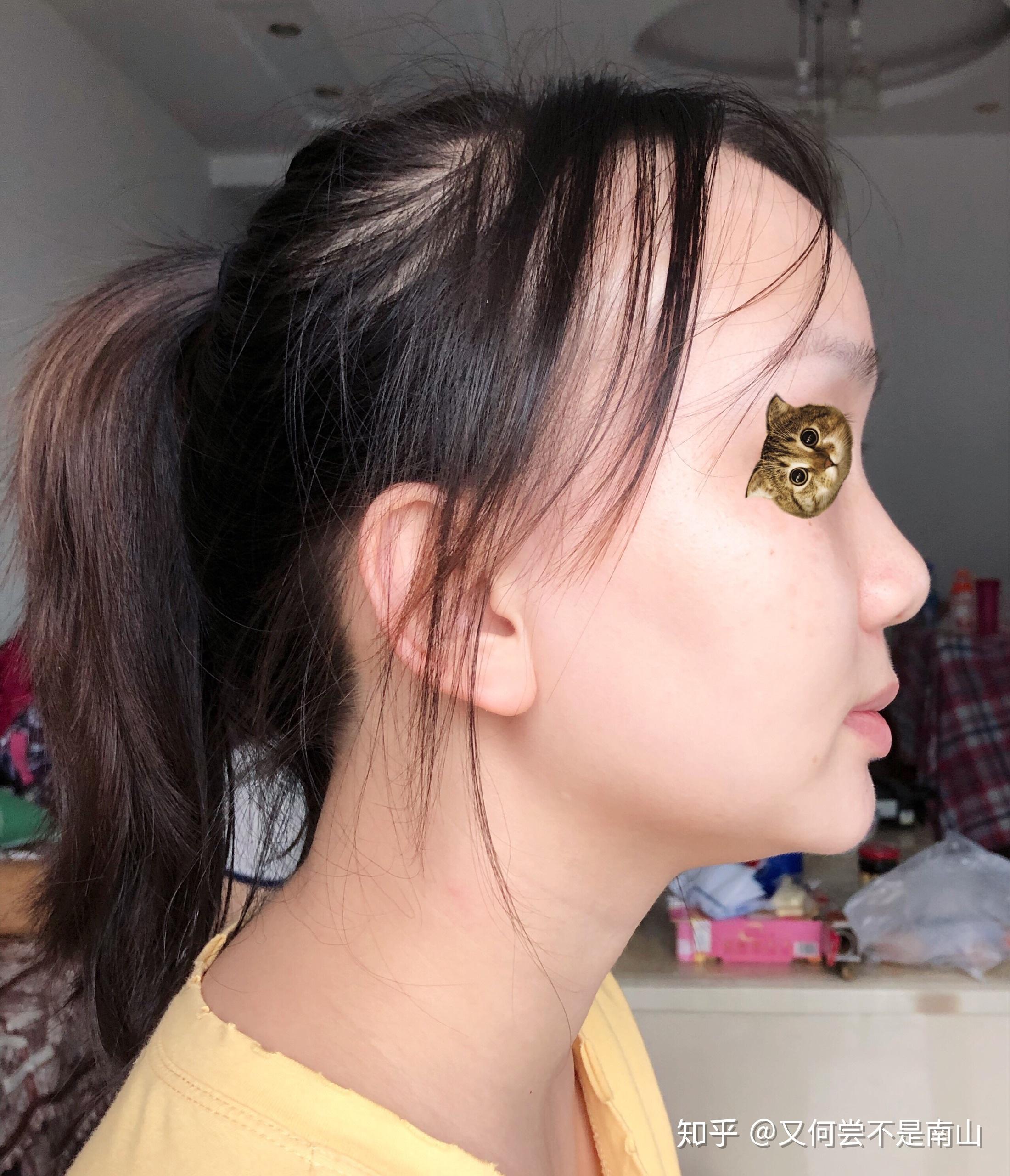 有一个超级扁平的侧脸是一种什么样的体验? - 知乎